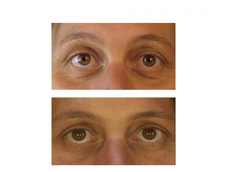 Diapositive2