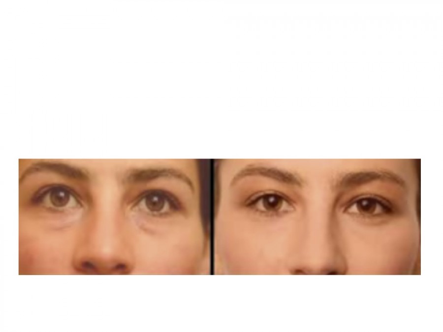 Diapositive4
