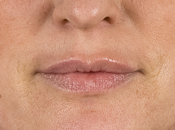 Lips_apres