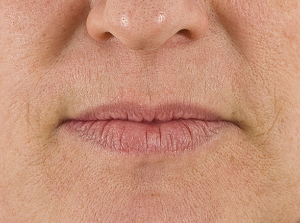 Lips_avant